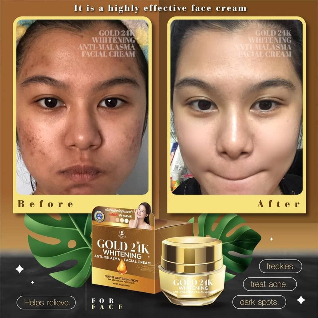Gold 24K Whitening Anti-Melasma Facial Cream