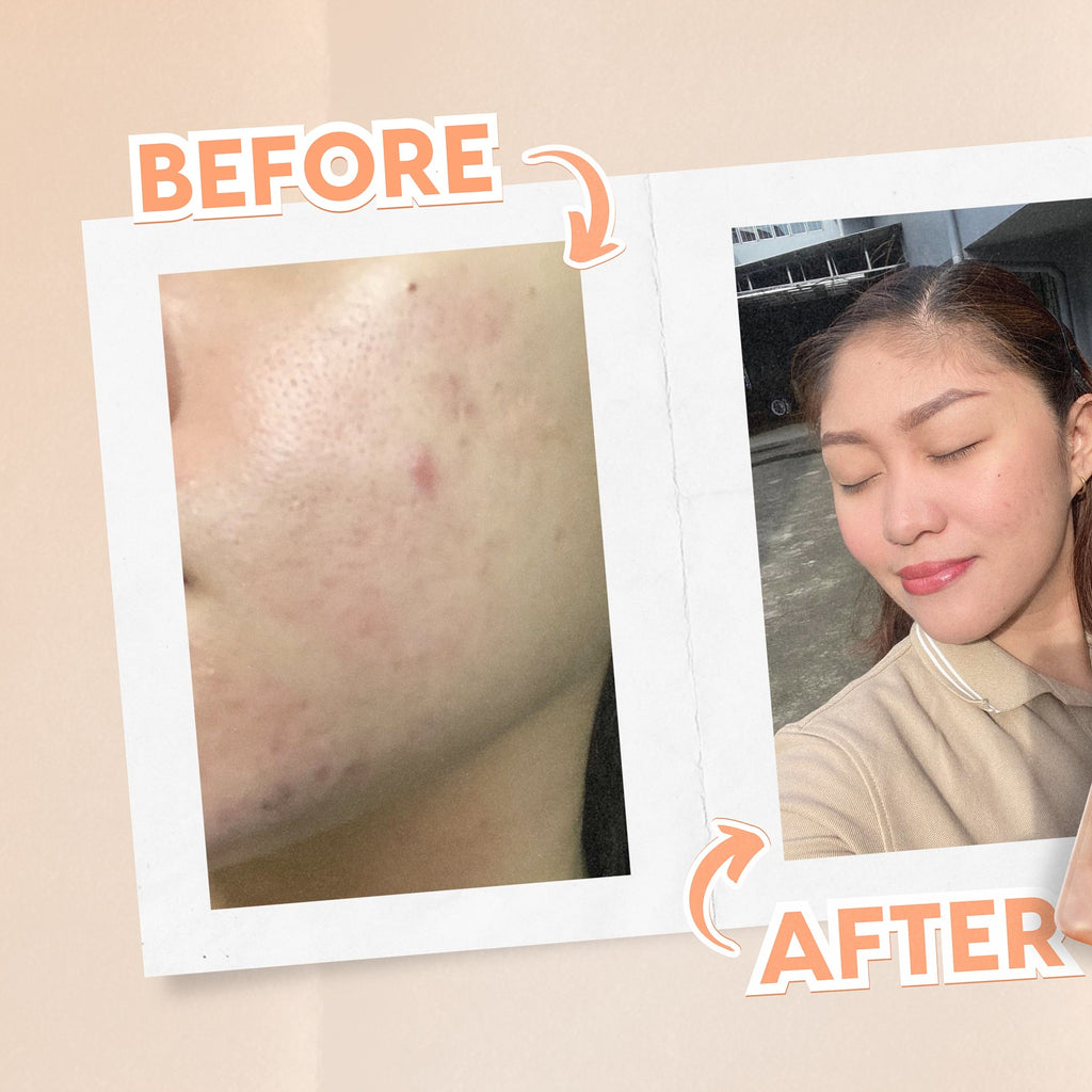 New Moon Soft Glow Glutathione | LOBeauty | Shop Filipino Beauty Brands in the UAE New Moon Soft Glow Glutathione | LOBeauty | Shop Filipino Beauty Brands in the UAE