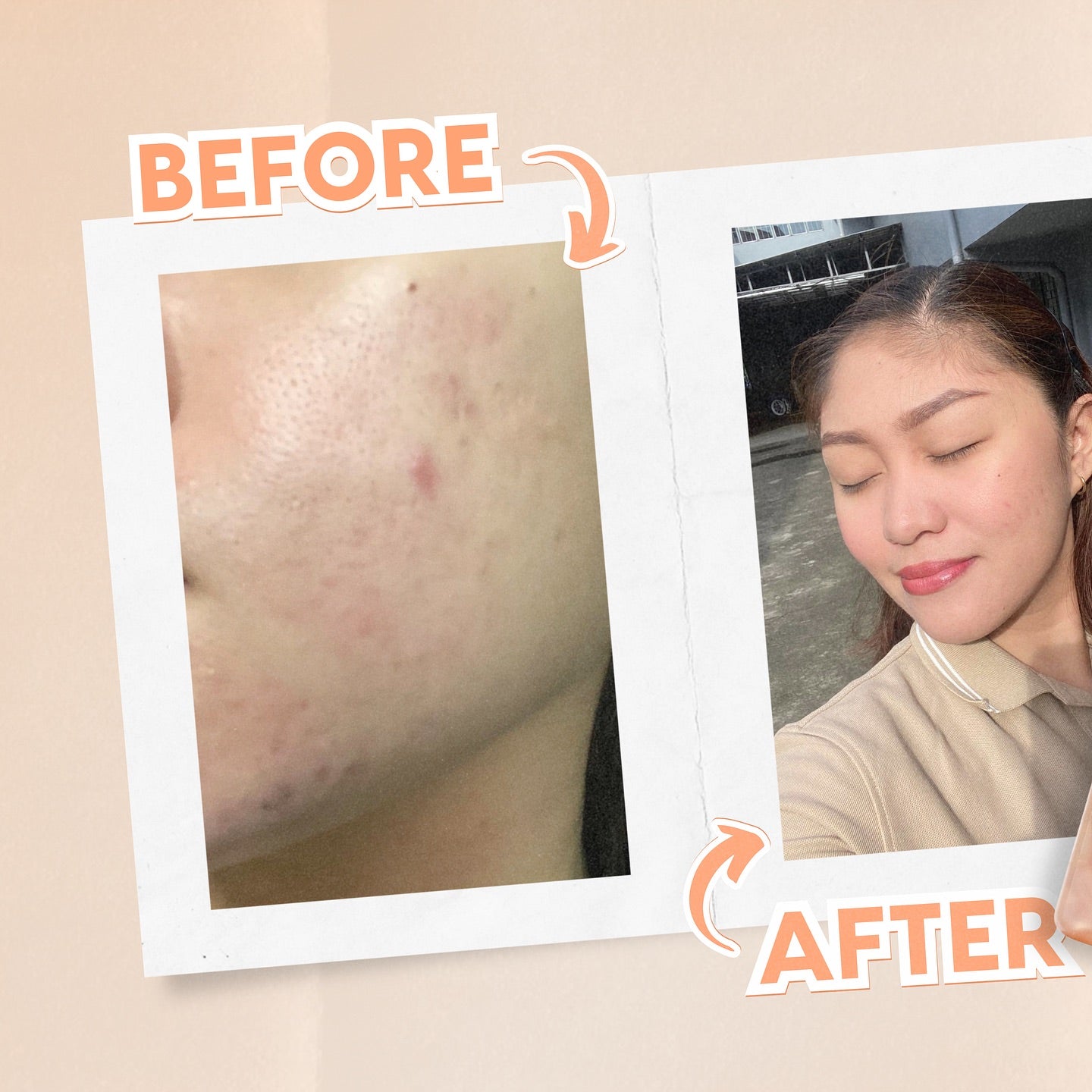 New Moon Soft Glow Glutathione | LOBeauty | Shop Filipino Beauty Brands in the UAE New Moon Soft Glow Glutathione | LOBeauty | Shop Filipino Beauty Brands in the UAE