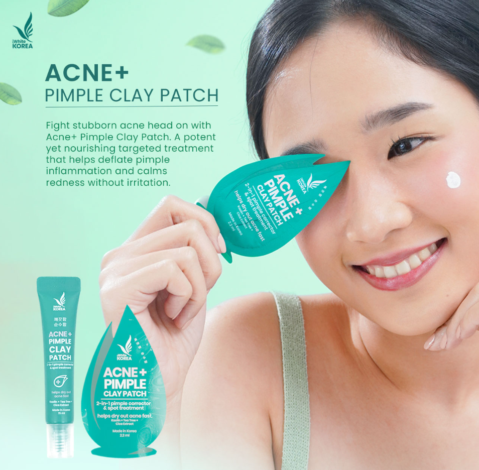 iWhite Korea Acne+ Pimple Clay Patch Tube 15ml