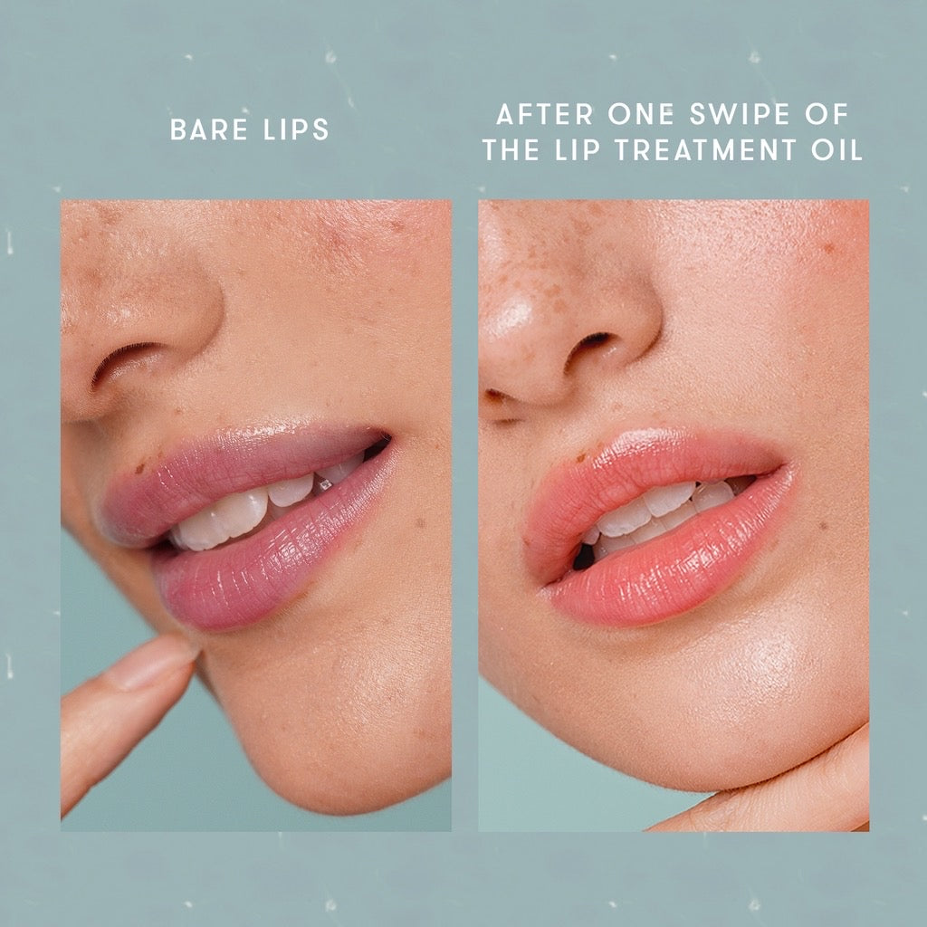 blk cosmetics Lip Treatment Oil Wondermelon - LOBeauty | Shop Filipino Beauty Brands in the UAE