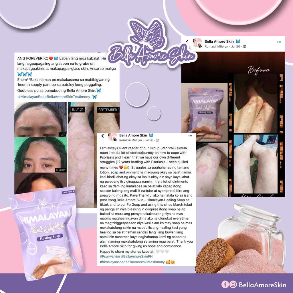 Himalayan Healing Soap by Bella Amore Skin - LOBeauty | Shop Filipino Beauty Brands in the UAE