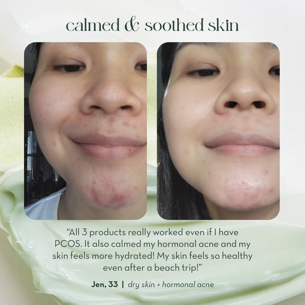 Happy Skin Overnight Calming Cream - LOBeauty | Shop Filipino Beauty Brands in the UAE