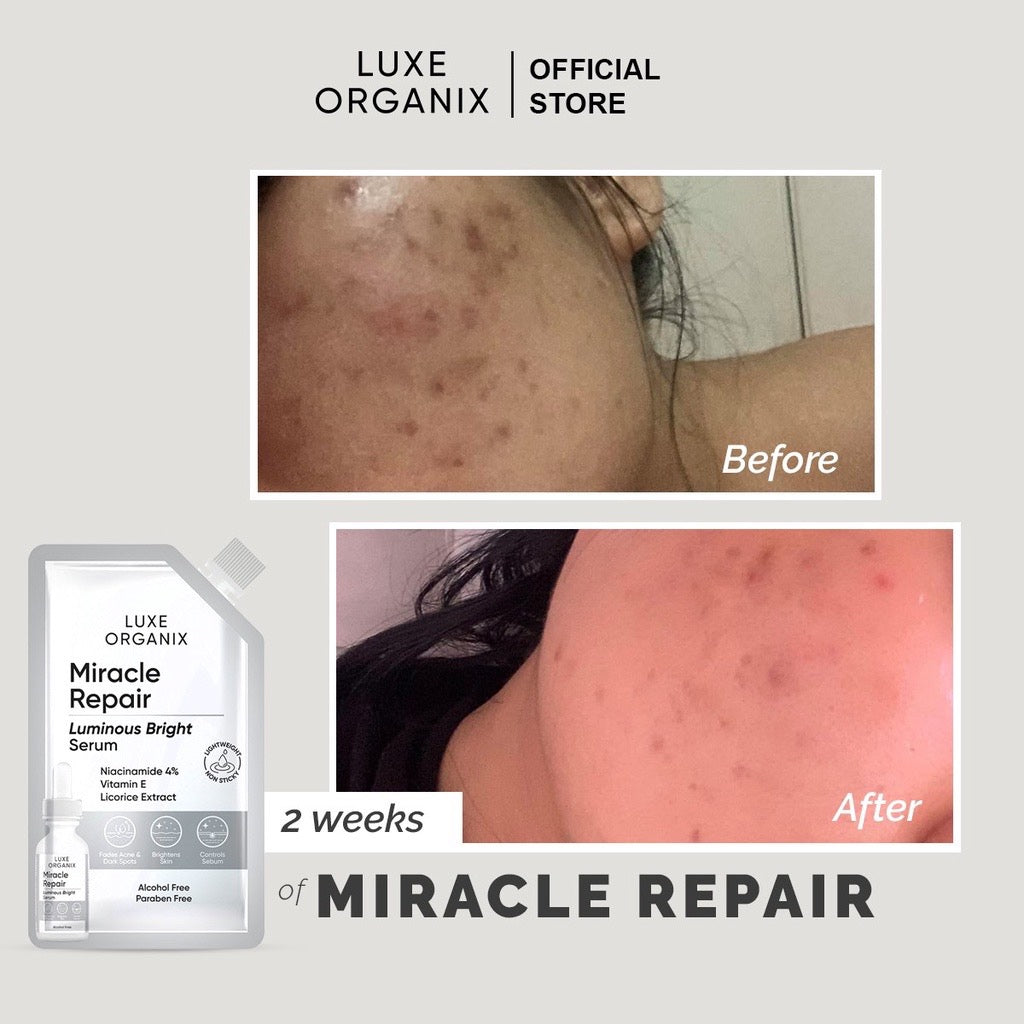 Luxe Organix Miracle Repair Luminous Bright Serum Sachet 7ml - LOBeauty | Shop Filipino Beauty Brands in the UAE