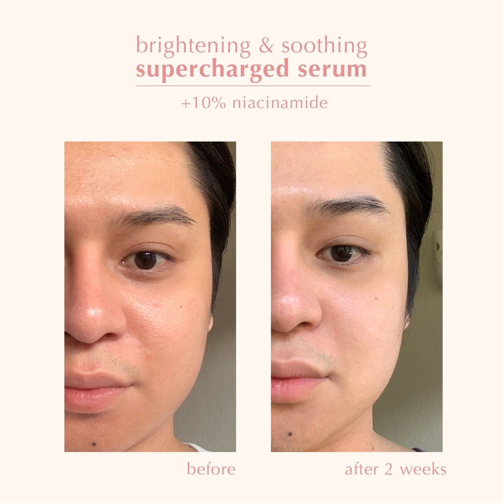 blk skin Brightening & Soothing Supercharged Serum + Niacinamide - LOBeauty | Shop Filipino Beauty Brands in the UAE
